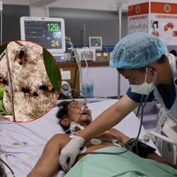 Người đàn ông kể giây phút bị ong vò vẽ đốt 150 vết, thoát chết sau 20 ngày điều trị