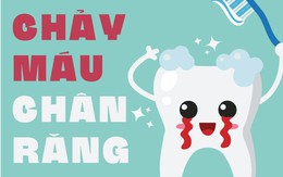 Chảy máu chân răng- triệu chứng xuất huyết não?