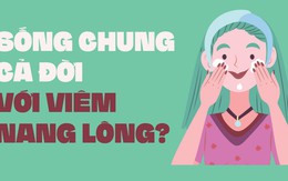 Phải sống chung cả đời với viêm nang lông?