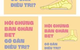 Hội chứng bàn chân bẹt có cần điều trị?