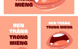 Lở miệng, nhưng chỉ xuất hiện vào ngày đầu và giữa tháng âm lịch?