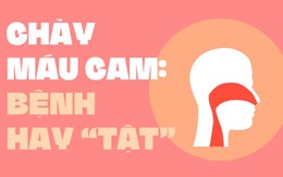 Mùa lạnh bị chảy máu mũi: bệnh hay tật?