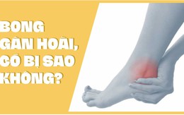 Bong gân hoài, có bị sao không?