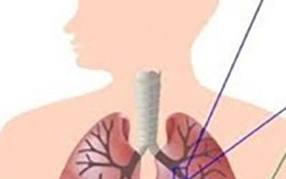 Bỏ thuốc lá để không gia nhập vào số 10 người chết/giây vì COPD!