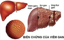 Xơi thực phẩm đường phố, coi chừng rước siêu vi viêm gan A