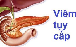 Viêm tụy cấp, có bỏ rượu thì mới không gặp...ông bà sớm!