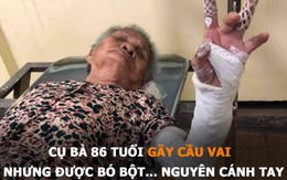 Vua Còm 20/5: Cụ bà gãy cầu vai được bó bột nguyên cánh tay