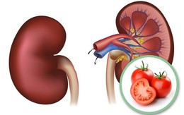 Ăn cà chua chỉ tốt khi đúng đối tượng, ăn sai dẫn đến 5 tác hại