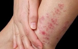 Muôn chuyện về chàm...