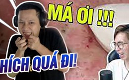 Tại sao nhiều người ghiền xem clip nặn mụn, thấy là share liền tay?