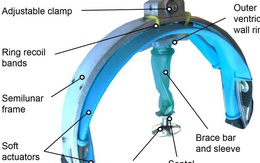 Đã có robot giúp tim chết lâm sàng có thể đập trở lại