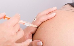 Một số phương pháp phát hiện Hội chứng Down trước khi sinh