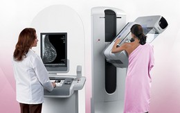 Nhũ ảnh: Lợi ích và những điều cần biết