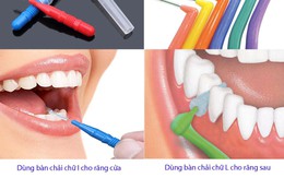 Vệ sinh răng bằng bàn chải kẽ