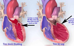 Những cách để phòng tránh suy tim