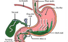 Trào ngược dịch mật