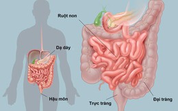 12 nguyên nhân gây đau bụng