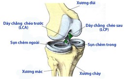 Đứt dây chằng chéo sau: Khi nào cần phẫu thuật?