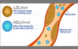 Phân biệt mỡ máu 'tốt' và 'xấu'