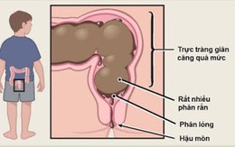 Giúp trẻ bỏ thói quen nhịn tiêu