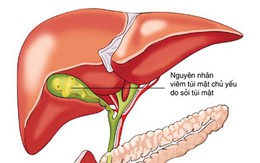 Cẩn thận với bệnh của túi mật