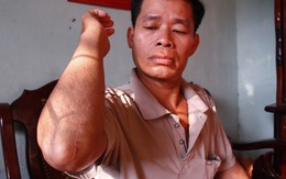 Người dân liên tiếp bị truy sát, công an nói đang điều tra