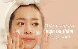 Hết mụn sạch thâm, da trắng mịn công nghệ Earl Peel 2018