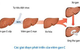 Biểu hiện viêm gan C ở phụ nữ