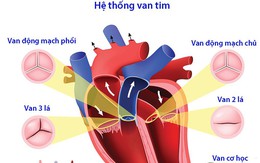 Các bệnh van tim thường gặp