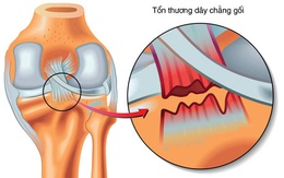 Phát hiện tế bào gốc dây chằng, sẽ hồi phục dây chằng không phải mổ?