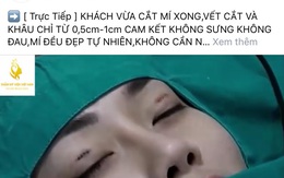 Đàn ông đi cắt mí, hút mỡ: những điều cần cảnh giác