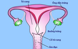 Viêm vùng chậu ở phụ nữ