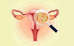 Phòng ngừa viêm nhiễm phụ khoa