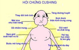 Hội chứng Cushing và bệnh Cushing