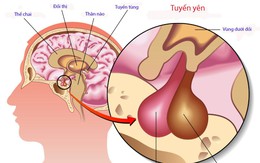 Thiếu hormone tăng trưởng ở trẻ nhỏ