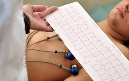 Điện tâm đồ (ECG)