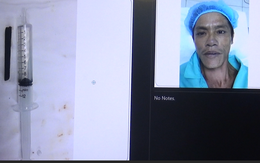 Nửa chiếc đũa nằm trong hốc mắt bệnh nhân suốt 4 năm