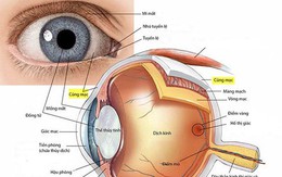 Viêm củng mạc