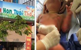 Tạm đình chỉ nhóm trẻ, lớp mẫu giáo có 3 trẻ bị bỏng do học phòng cháy nổ