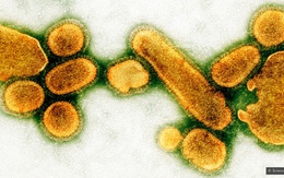 Điều gì xảy xa nếu một ngày tất cả virus biến mất?