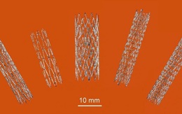 Australia tạo đột phá trong sản xuất stent nhờ công nghệ in 3D