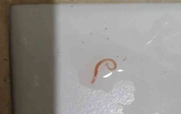 Xuất hiện sinh vật lạ trong nước máy ở Hàn Quốc