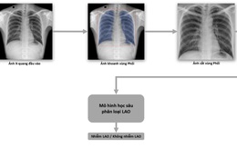Phát hành sách trắng về ứng dụng trí tuệ nhân tạo cho chẩn đoán và tầm soát bệnh lao