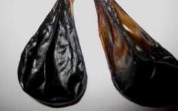 Bé 9 ngày tuổi được cho uống mật khỉ phòng co giật, thêm nguy kịch