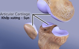 Phát triển sụn khớp nhân tạo có tính ứng dụng cao
