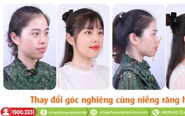 Nha khoa VIET SMILE - Niềng răng mắc cài thấy trước kết quả