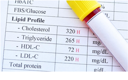 Cholesterol “tốt” không có lợi như người ta tưởng