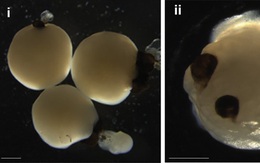 Những bộ não mini tạo ra từ tế bào gốc đã tự phát triển thêm đôi mắt