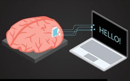 Giao diện não - máy tính giúp người liệt nói chuyện đạt tốc độ kỷ lục