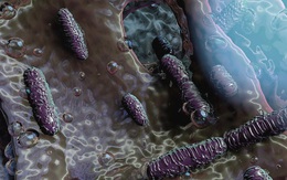 Mexico: Nhiều trẻ em tử vong do nhiễm vi khuẩn Klebsiella oxytoca